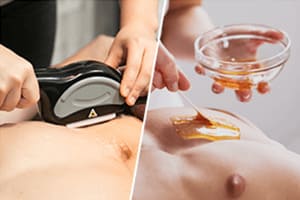 選べる脱毛方法