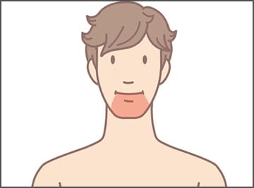 ヒゲ1点