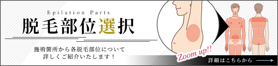 脱毛部位選択