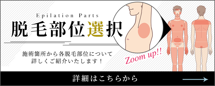 脱毛部位選択