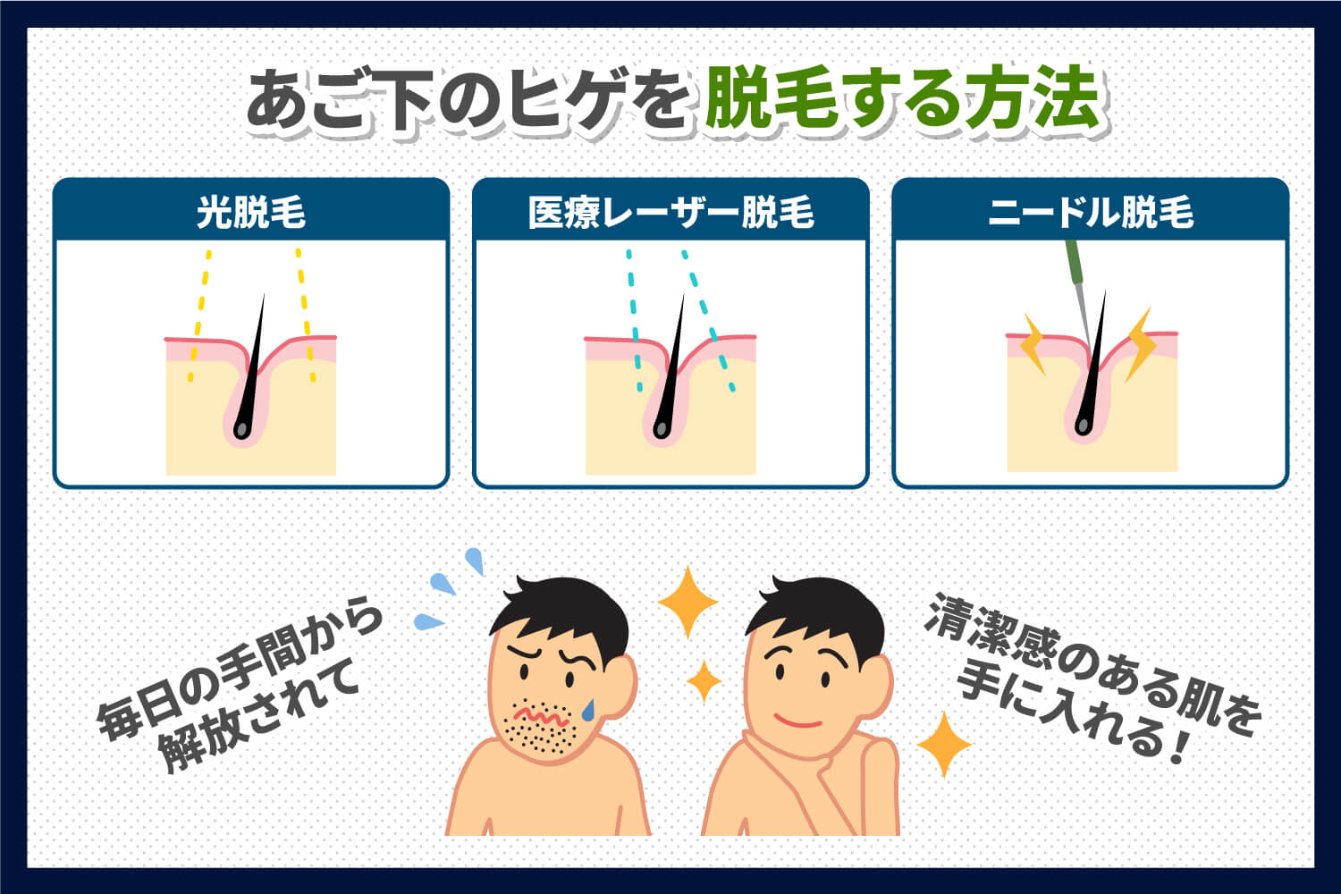 詳しく解説！あご下のヒゲを脱毛する方法とは？ - 【公式】メンズ