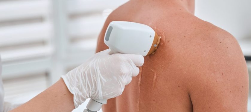 周りに気づかれずに変われる?冬スタート脱毛のリアル