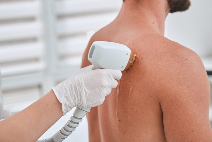 周りに気づかれずに変われる？冬スタート脱毛のリアル