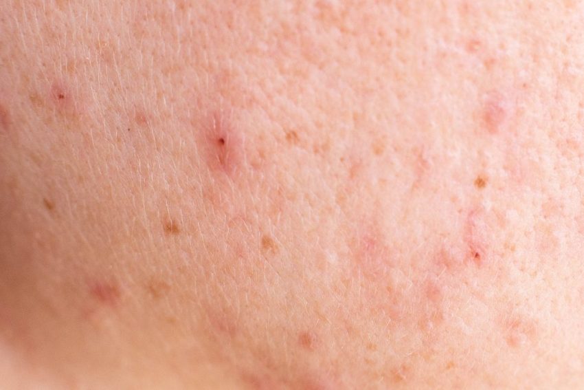 実は男性の肌は想像以上に無防備